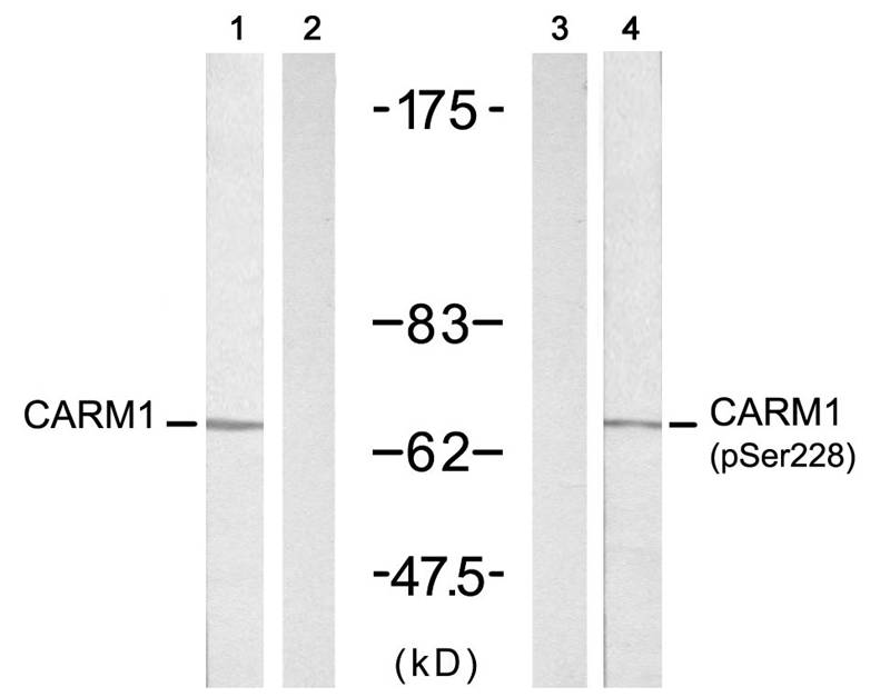 CARM1(Ab-228)