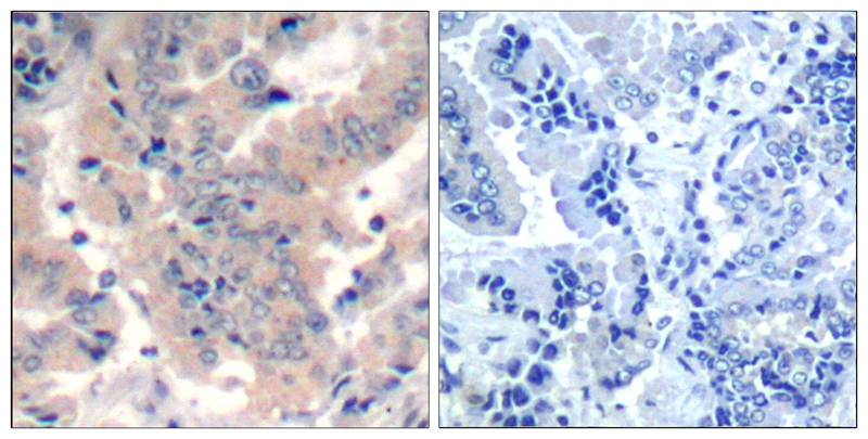 PI3 Kinase p85/p55(Ab-467/199)