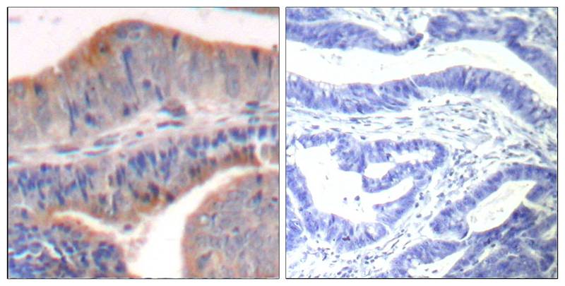 Rabbit Polyclonal Antibody to stathmin1(Ab-62)