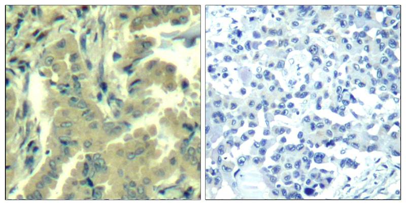 Rabbit Polyclonal Antibody to PLC-g2(Ab-1217)