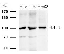 GIT1 (Ab-383)