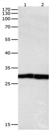 DUSP6