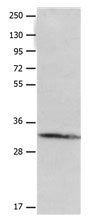 AQP1