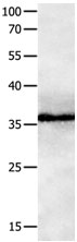 GPR3