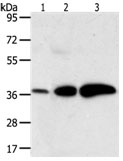 AKR1C1