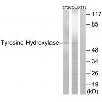 Tyrosine Hydroxylase (Ab-19)