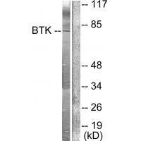 BTK (Ab-222)
