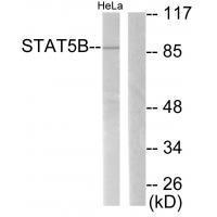 STAT5B (Ab-731)