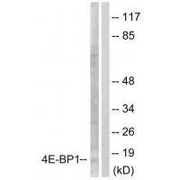 4E-BP1 (Ab-64)
