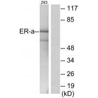 Estrogen Receptor-α (Ab-537)