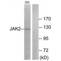 JAK2 (Ab-570)