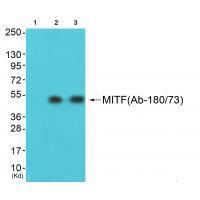 MITF (Ab-180/73)