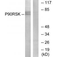 p9RSK (Ab-573)