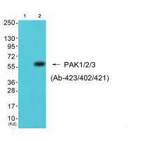 Rabbit Polyclonal Antibody to PAK1/2/3 (Ab-423/402/421)