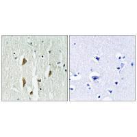 Rabbit Polyclonal Antibody to PAK1/2/3 (Ab-423/402/421)