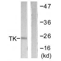 TK (Ab-13)