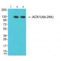 ACK1 (Ab-284)