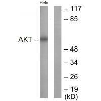 Akt (Ab-326)