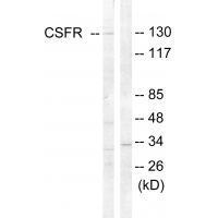 CSFR (Ab-809)