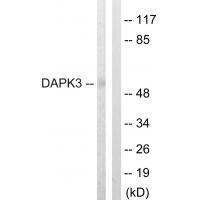 DAPK3 (Ab-265)