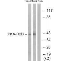 PKA-R2β (Ab-113)