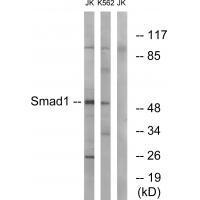 Smad1 (Ab-187)