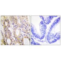 Rabbit Polyclonal Antibody to Smad3 (Ab-204)