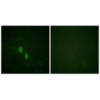 Rabbit Polyclonal Antibody to hnRPD (Ab-83)