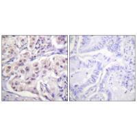 Rabbit Polyclonal Antibody to hnRPD (Ab-83)