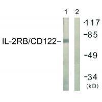 IL-2Rβ/CD122 (Ab-364)