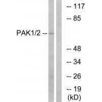 PAK1/2 (Ab-199)