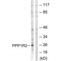 PPP1R2 (Ab-120/121)