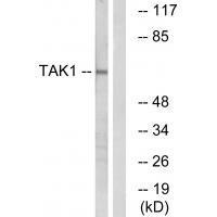 TAK1 (Ab-184)