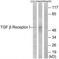 TGF β Receptor I (Ab-165)