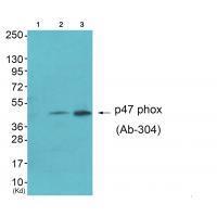 Neutrophil Cytosol Factor 1 (Ab-304)