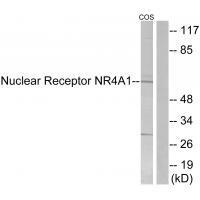 Nuclear Receptor NR4A1 (Ab-351)