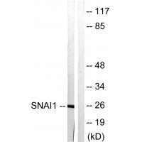 SNAI1 (Ab-246)