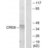 CREB (Ab-129/133)