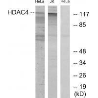 HDAC4 (Ab-632)