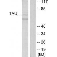 Tau (Ab-396)
