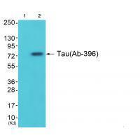 Rabbit Polyclonal Antibody to Tau (Ab-396)