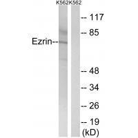 Ezrin (Ab-478)