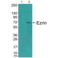 Rabbit Polyclonal Antibody to Ezrin (Ab-478)