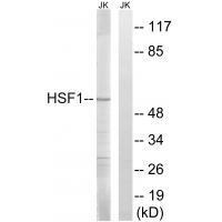HSF1 (Ab-121)