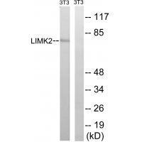 LIMK2 (Ab-283)