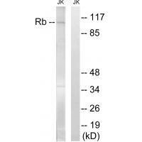 Retinoblastoma (Ab-608)