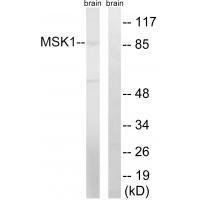 MSK1 (Ab-212)