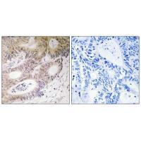 Rabbit Polyclonal Antibody to MSK1 (Ab-212)