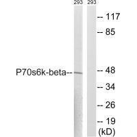 p7S6 Kinase β (Ab-423)