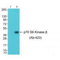 Rabbit Polyclonal Antibody to p7S6 Kinase β (Ab-423)